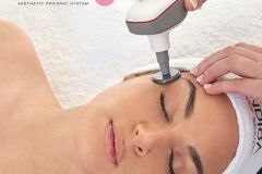INDIBA-EDNAPRO-facial- ana-valero